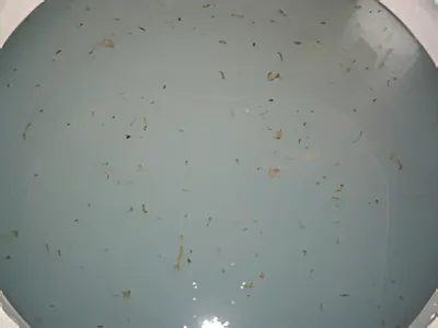 洗濯槽から浮き出た大量の黒カビ